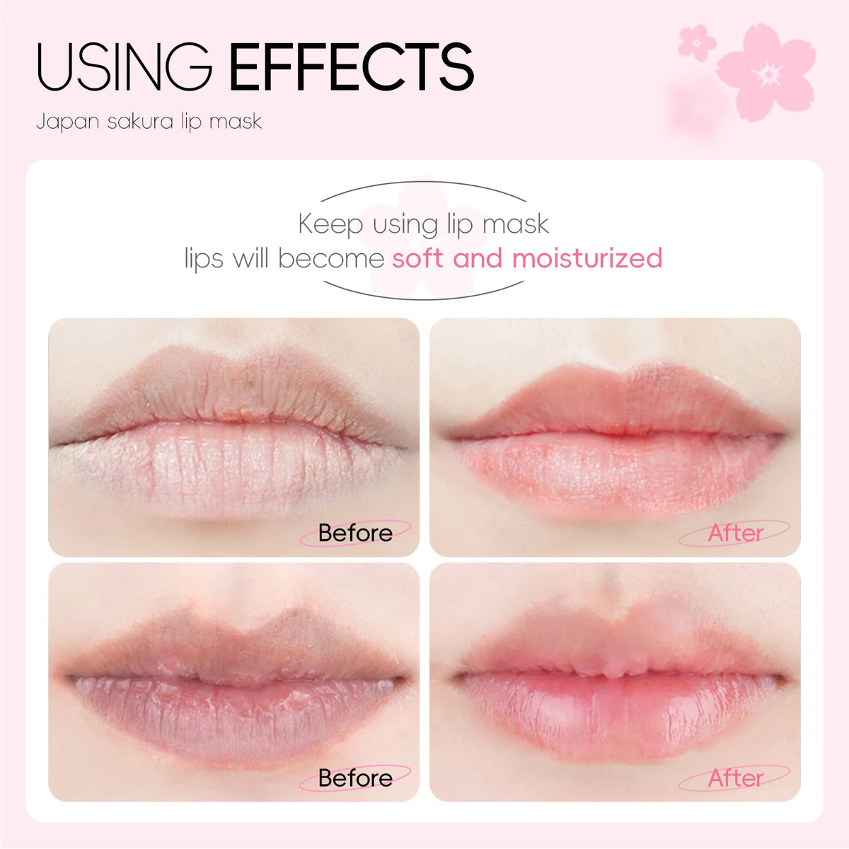 LAIKOU Hydrating Lip Masks – lip masks, view 2