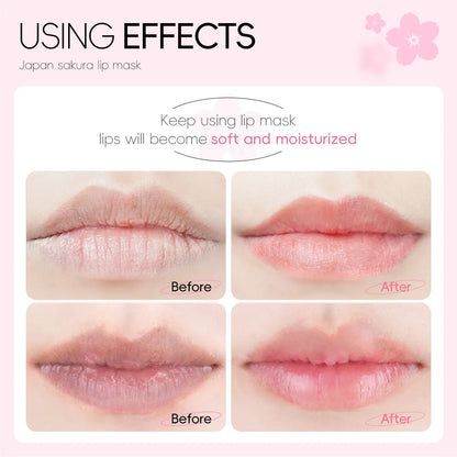 LAIKOU Hydrating Lip Masks – lip masks, view 2