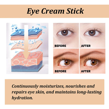 Hoygi Snail Peptide Eye Cream Stick – eye creams, view 5