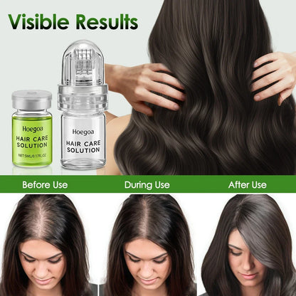 Hair Essential Care Serum Strengthen Roots Reducing Loss Prevent Baldness Nourish Scalp Hair Care Anti-Hair Loss Conditioner
